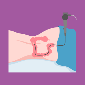 Graphic design image of a person lying down for a colonoscopy.